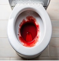 ���ւ��o���g�C���̉摜